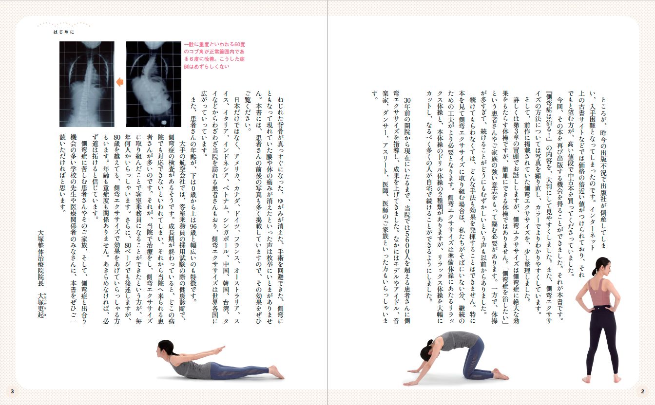側弯症は自分で治せる! (専門治療院が教える驚きの実践的